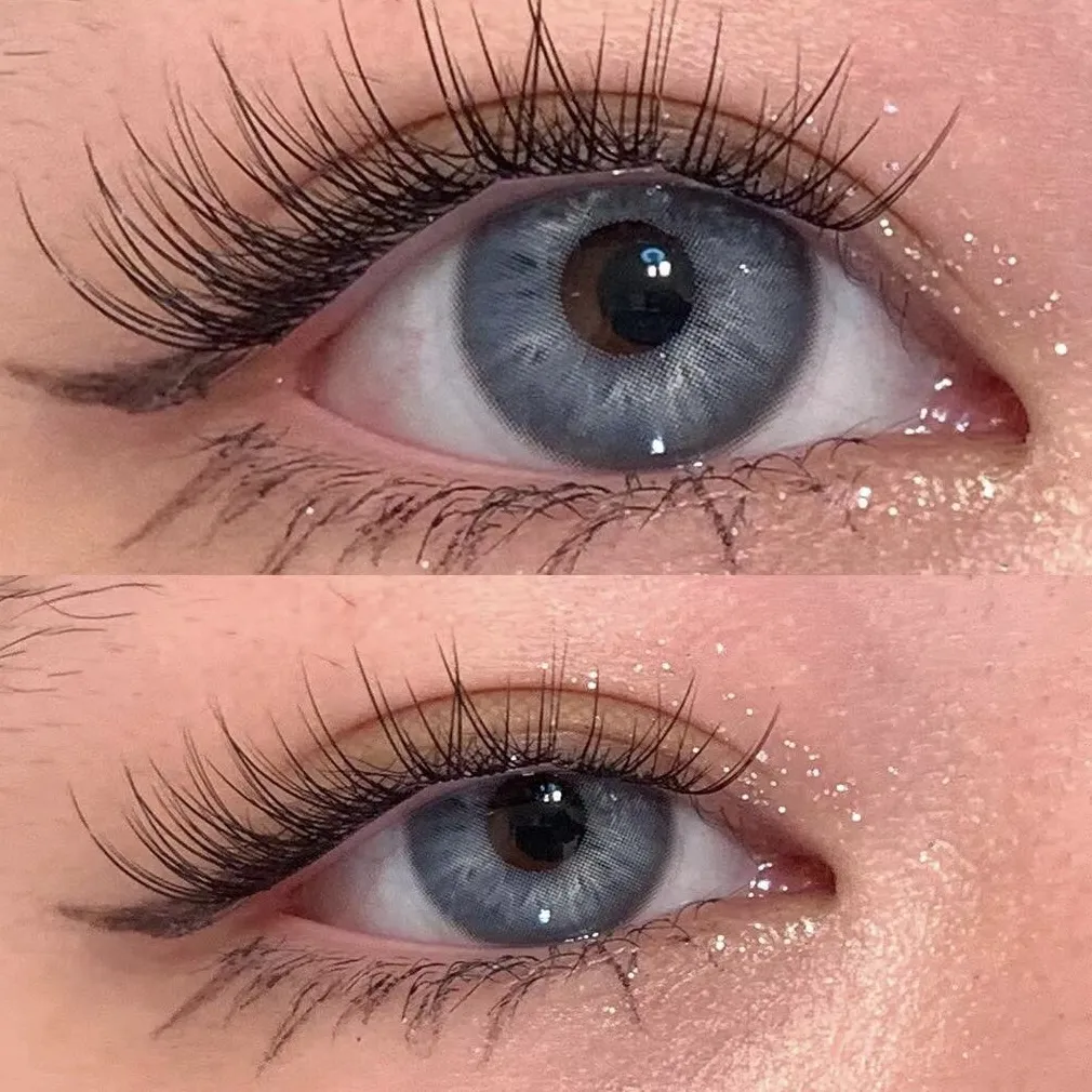 EyeLensy Irish Blue | 1 Year
