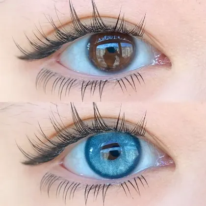 EyeLensy Aloe Blue | 1 Year