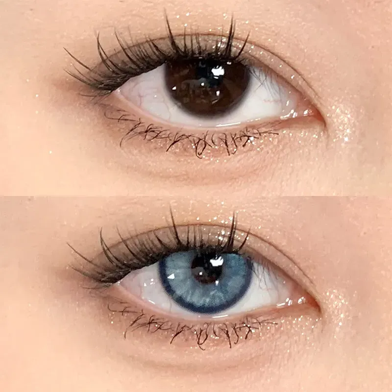 EyeLensy Aloe Blue | 1 Year